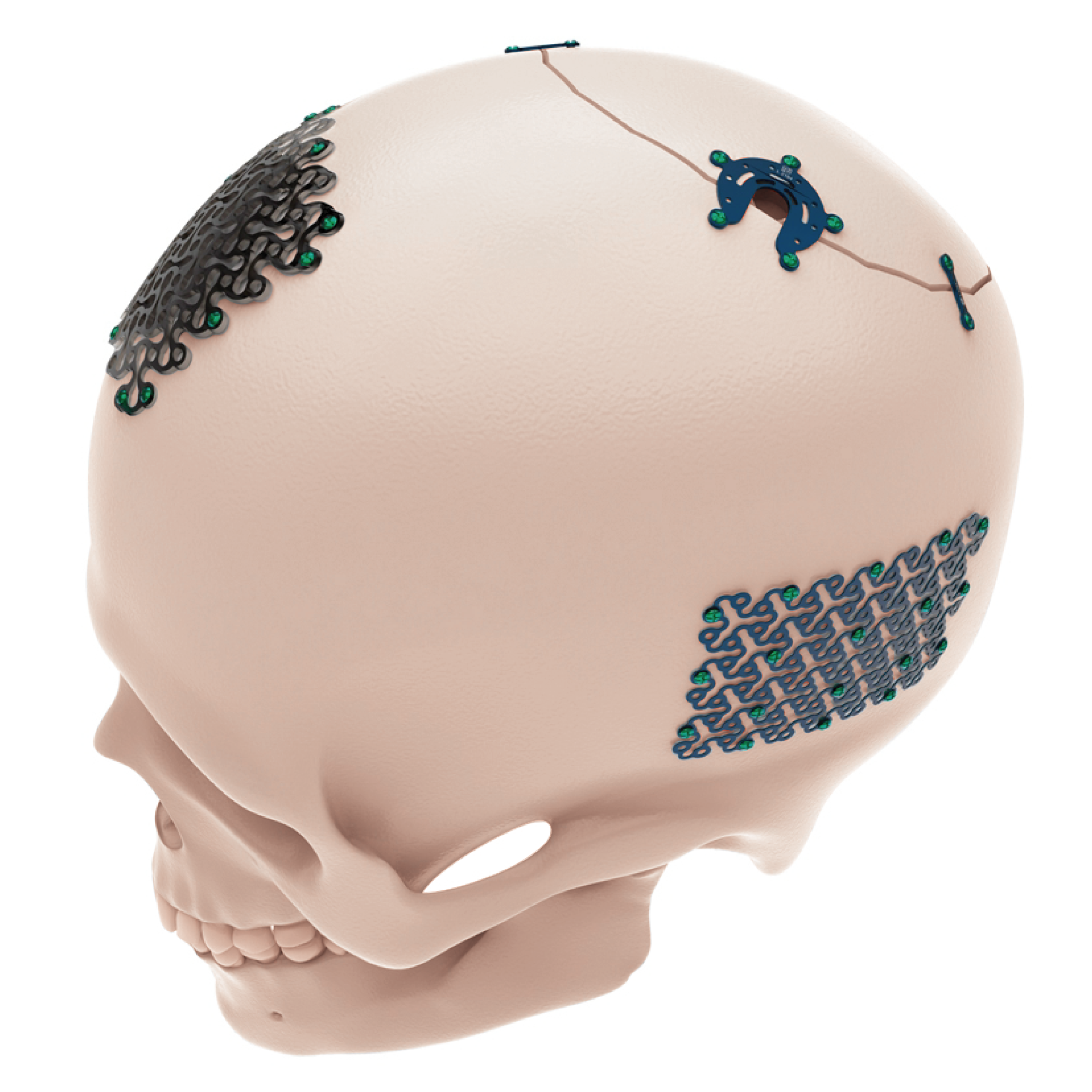 SISTEMA-CRANIOMAXILOFACIAL-09